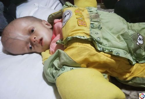 青海男子年近不惑喜得千金，数月后孩子头部异常引关注，婴幼儿临时看护问题凸显